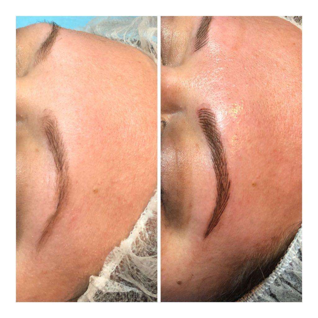 Microblading Skin2O Spa Before and After