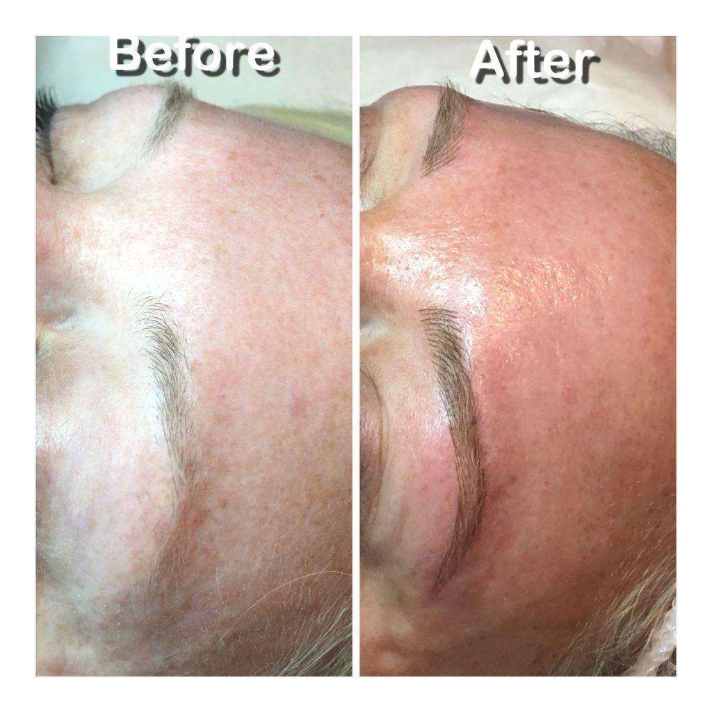 Microblading Skin2O Spa Before and After