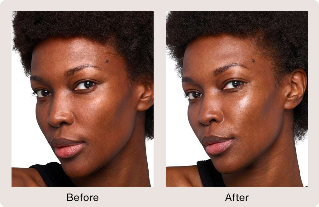 SkinVIVE Before and After