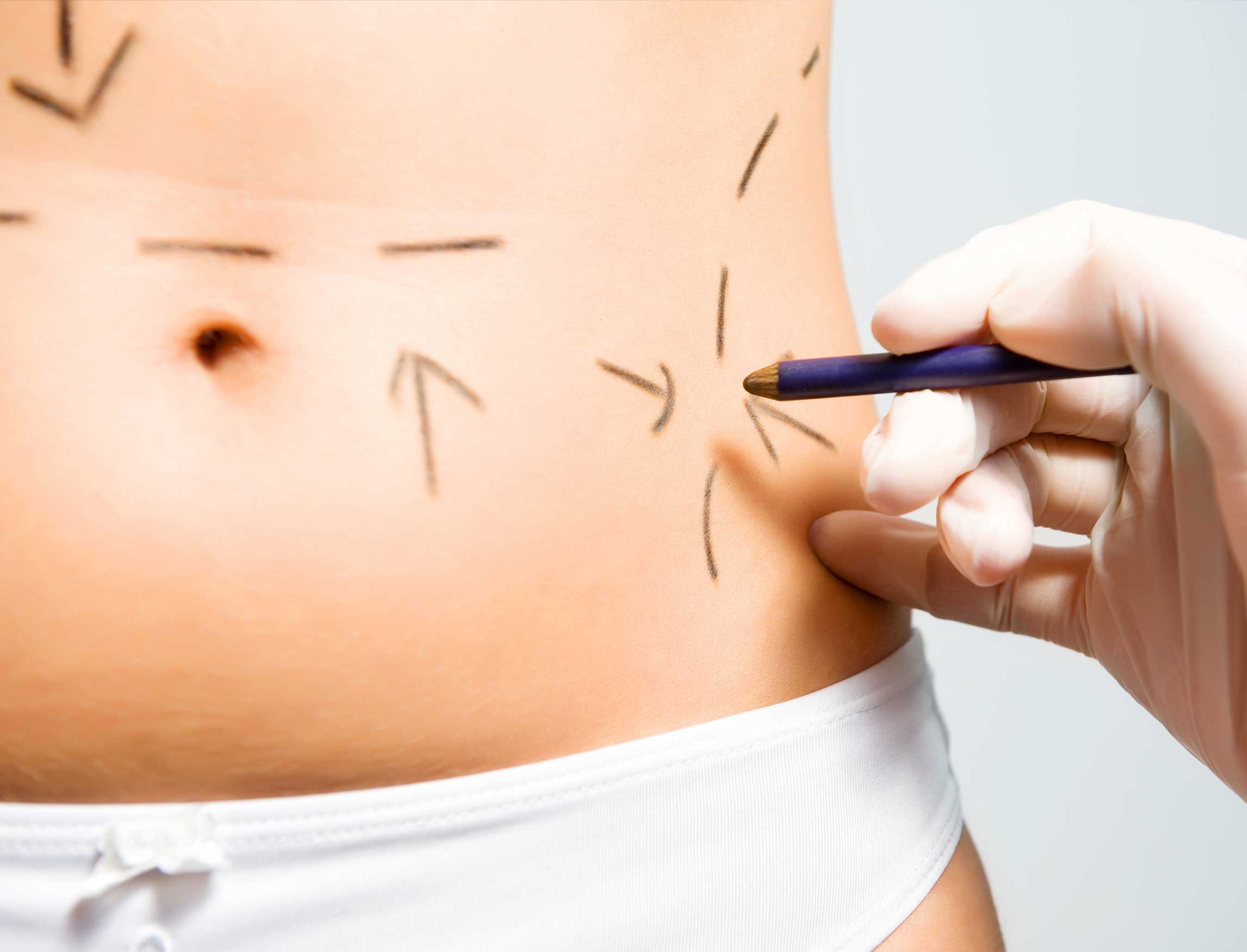 Surgical Procedures