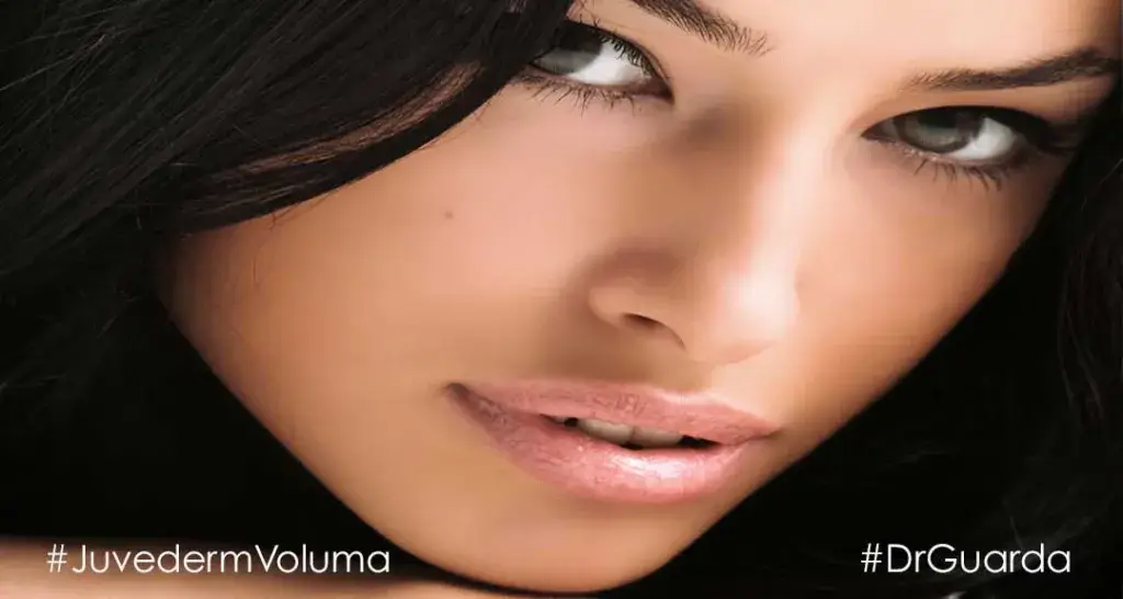 Juvederm Voluma
